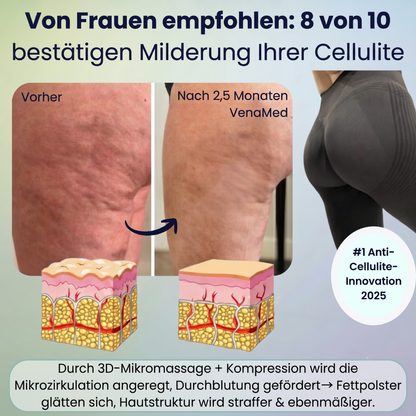 VenaMed Shorts - Kurze Kompressionsleggings I Erleichterung bei Venenbeschwerden & schweren Beinen