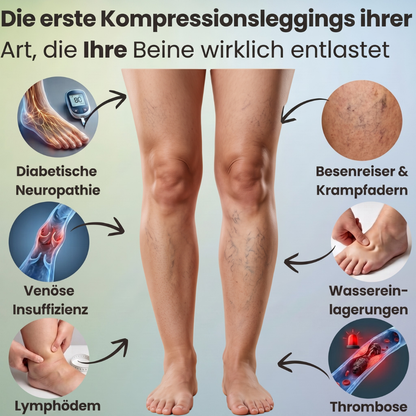 VenaMed Shorts - Kurze Kompressionsleggings I Erleichterung bei Venenbeschwerden & schweren Beinen