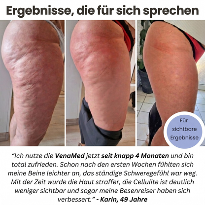 VenaMed Shorts - Kurze Kompressionsleggings I Erleichterung bei Venenbeschwerden & schweren Beinen