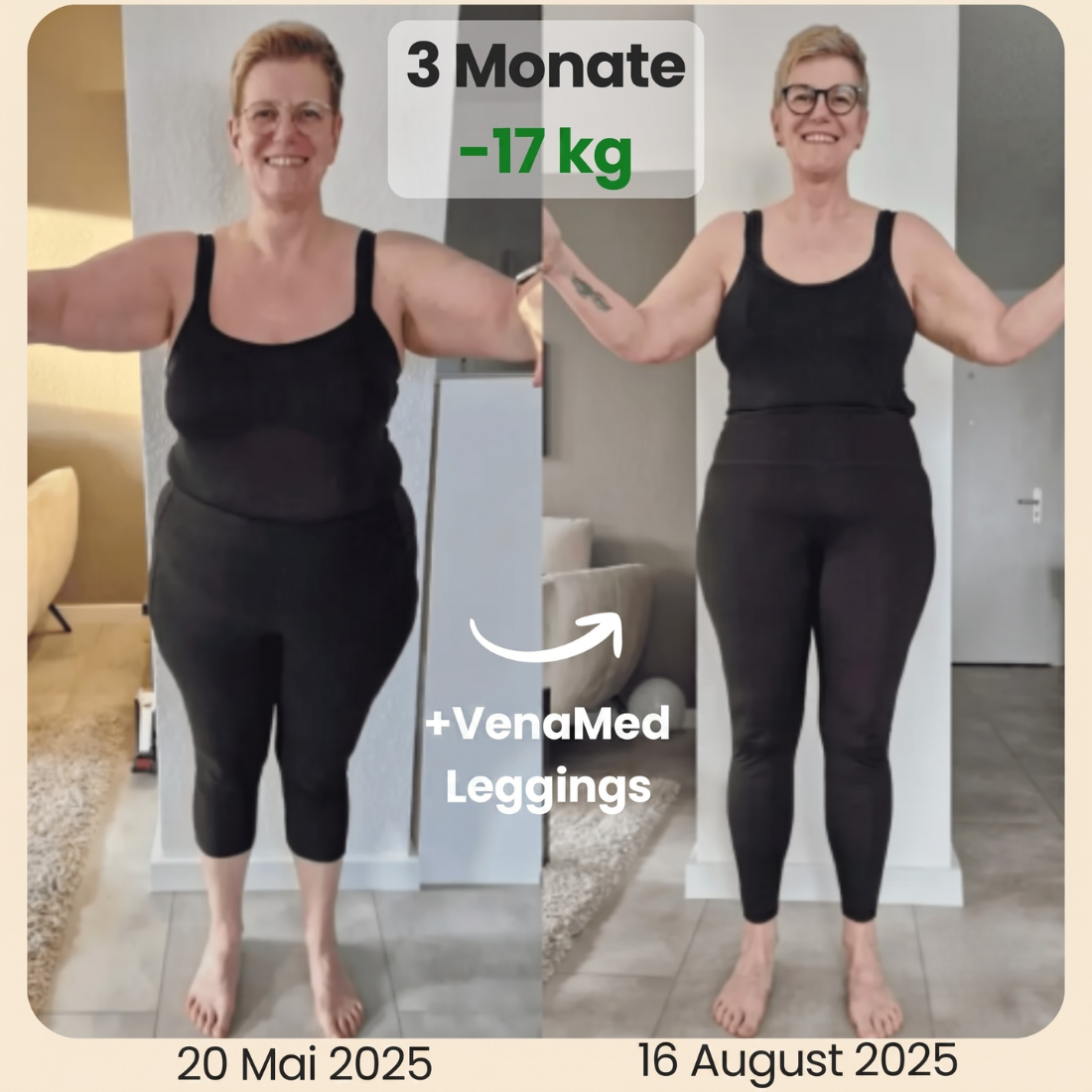 VenaMed - Kompressionsleggings I Mit Kalorien-Boost & Hautstraffung